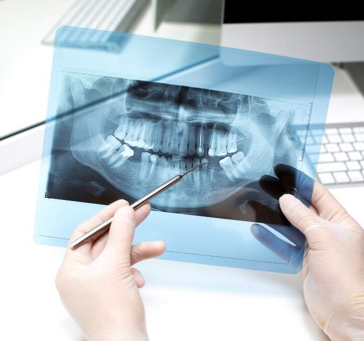 3d scans and x-rays